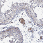 FKBP12 Antibody in Immunohistochemistry (Paraffin) (IHC (P))