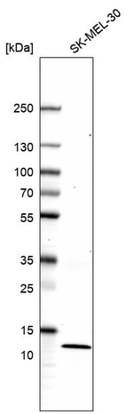 FKBP12 Antibody in Western Blot (WB)
