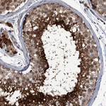 PCYT2 Antibody in Immunohistochemistry (Paraffin) (IHC (P))