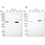 PCYT2 Antibody in Western Blot (WB)