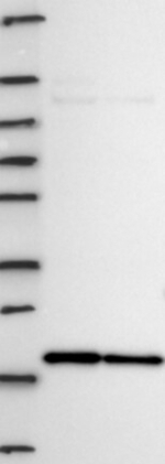 NAT13 Antibody in Western Blot (WB)