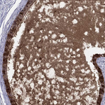 DEFB121 Polyclonal Antibody