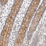 ADAMTS9 Antibody in Immunohistochemistry (Paraffin) (IHC (P))