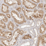 ADAMTS9 Antibody in Immunohistochemistry (Paraffin) (IHC (P))