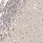 ADAMTS9 Antibody in Immunohistochemistry (Paraffin) (IHC (P))