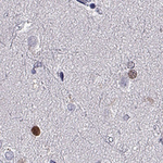 SOX21 Antibody in Immunohistochemistry (Paraffin) (IHC (P))
