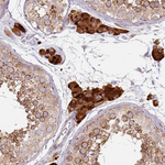 Prokineticin Receptor 2 Antibody in Immunohistochemistry (Paraffin) (IHC (P))