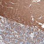 LGR7 Antibody in Immunohistochemistry (Paraffin) (IHC (P))
