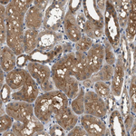 GPR31 Polyclonal Antibody