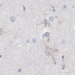 KCNH8 Polyclonal Antibody