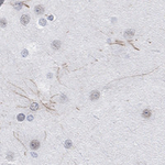 KCNH8 Antibody in Immunohistochemistry (Paraffin) (IHC (P))