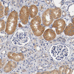 PCSK6 Antibody in Immunohistochemistry (Paraffin) (IHC (P))