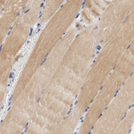 PCSK6 Antibody in Immunohistochemistry (Paraffin) (IHC (P))