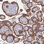 CYSLTR2 Polyclonal Antibody