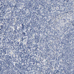 Versican Antibody in Immunohistochemistry (Paraffin) (IHC (P))