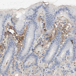 Versican Antibody in Immunohistochemistry (Paraffin) (IHC (P))