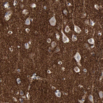 Versican Antibody in Immunohistochemistry (Paraffin) (IHC (P))