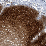 OR51E1 Antibody in Immunohistochemistry (Paraffin) (IHC (P))