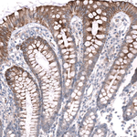 MRGPRX2 Antibody in Immunohistochemistry (Paraffin) (IHC (P))