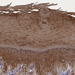KRT9 Antibody in Immunohistochemistry (Paraffin) (IHC (P))