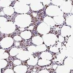 CLEC1B Antibody in Immunohistochemistry (Paraffin) (IHC (P))