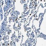 SLA Polyclonal Antibody