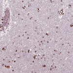 PIP4K2A Polyclonal Antibody