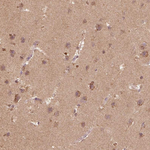 beta-1,2 Adaptin Polyclonal Antibody