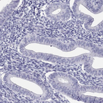 PDE6A Antibody in Immunohistochemistry (Paraffin) (IHC (P))