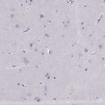 PDE6A Antibody in Immunohistochemistry (Paraffin) (IHC (P))