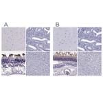 PDE6A Polyclonal Antibody