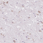 FZD5 Antibody in Immunohistochemistry (Paraffin) (IHC (P))