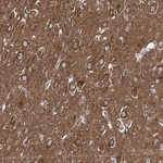 ADCY2 Polyclonal Antibody