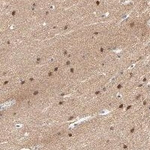 FBXL5 Antibody in Immunohistochemistry (Paraffin) (IHC (P))