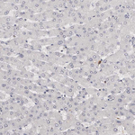 TNNI1 Antibody in Immunohistochemistry (Paraffin) (IHC (P))