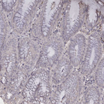 TNNI1 Antibody in Immunohistochemistry (Paraffin) (IHC (P))