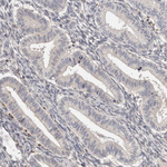 TNNI1 Antibody in Immunohistochemistry (Paraffin) (IHC (P))