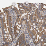 TOM1L1 Antibody in Immunohistochemistry (Paraffin) (IHC (P))