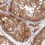 MMP15 Polyclonal Antibody