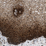 PRDM14 Polyclonal Antibody