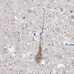 MC3R Polyclonal Antibody