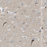 GPR34 Polyclonal Antibody