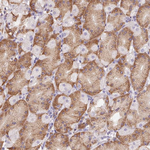 ADAM8 Antibody in Immunohistochemistry (Paraffin) (IHC (P))