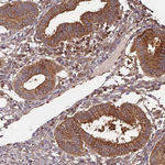 ACVR2A Antibody in Immunohistochemistry (Paraffin) (IHC (P))