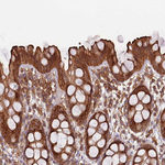 ACVR2A Antibody in Immunohistochemistry (Paraffin) (IHC (P))