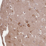 ACVR2A Antibody in Immunohistochemistry (Paraffin) (IHC (P))