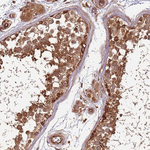 ACVR2A Polyclonal Antibody