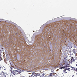 ACVR2A Antibody in Immunohistochemistry (Paraffin) (IHC (P))