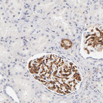 ITGA8 Antibody in Immunohistochemistry (Paraffin) (IHC (P))