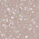 KCNH6 Antibody in Immunohistochemistry (Paraffin) (IHC (P))